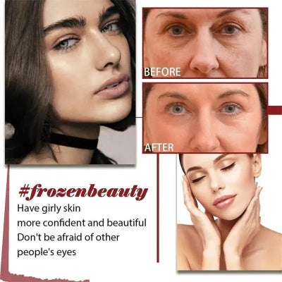 Retinol en Crema/Serum/Eyestick.