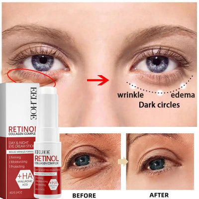 Retinol en Crema/Serum/Eyestick.