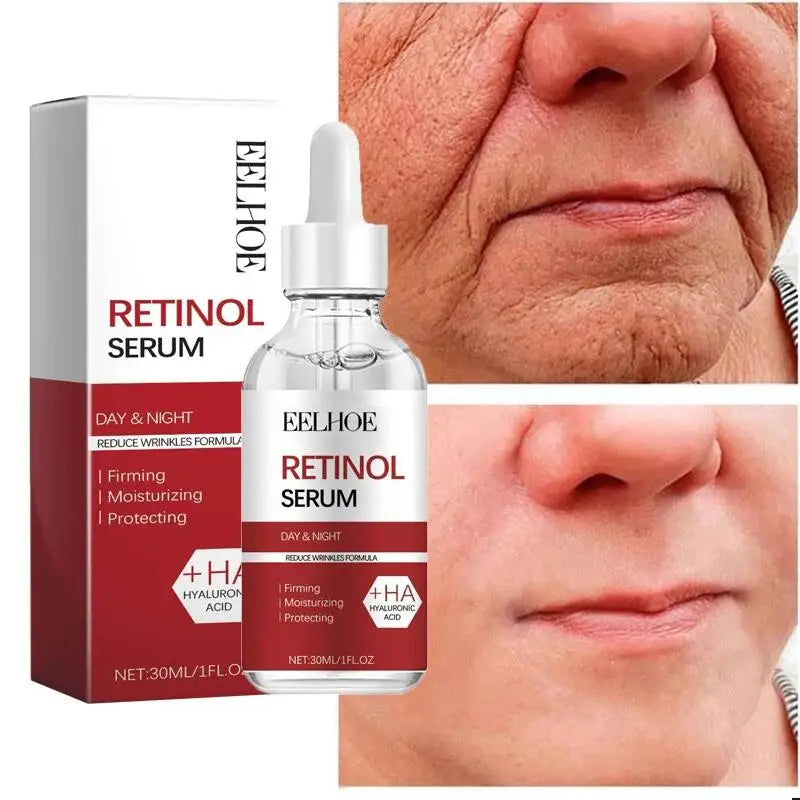 Retinol en Crema/Serum/Eyestick.